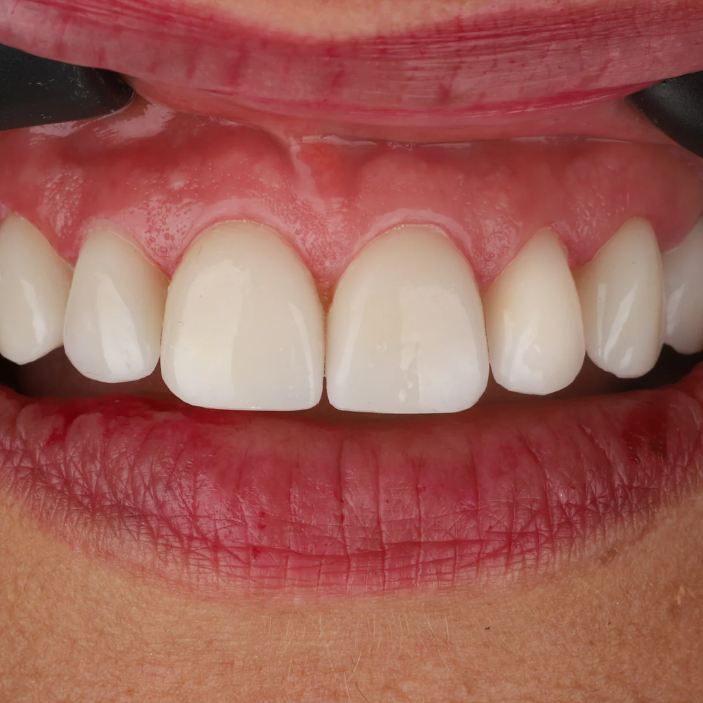 Prizma 3d Resin Bio Crown - 250gr