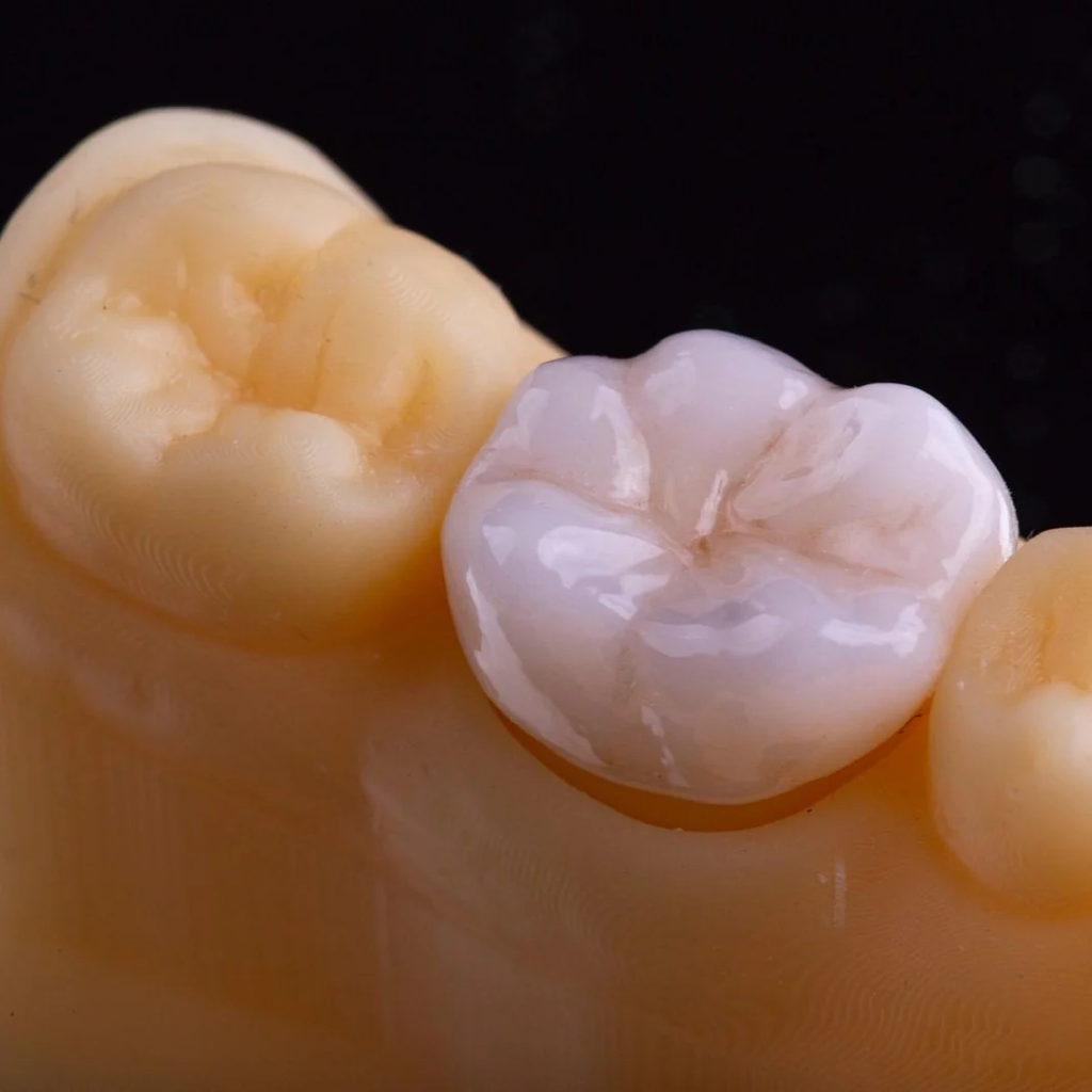 Prizma 3d Resin Bio Crown Diamond - 300gr