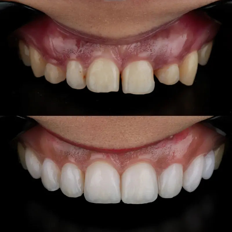 PriZma3D Resin Bio Crown - 250gr