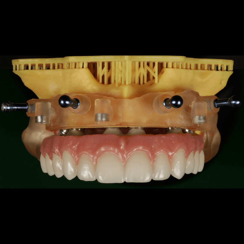 PriZma3D Resin Bio Guide - Amber - Autoclavable 1 kg