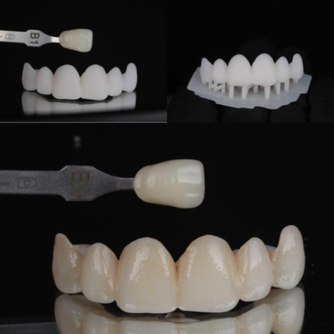 PriZma3D Resin Tray-In